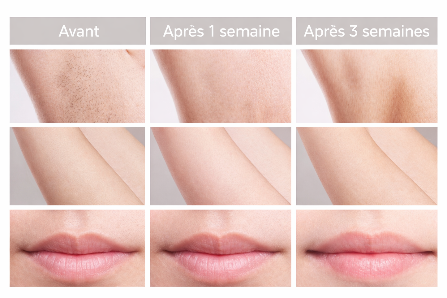 Intense Pulsed Light Hair Removal Device: Long-Lasting Hair Reduction for Face &amp; Body