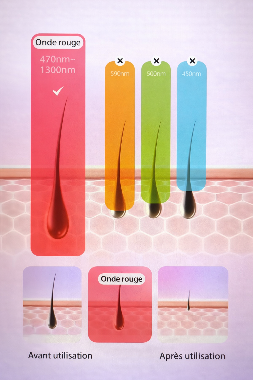 Intense Pulsed Light Hair Removal Device: Long-Lasting Hair Reduction for Face &amp; Body