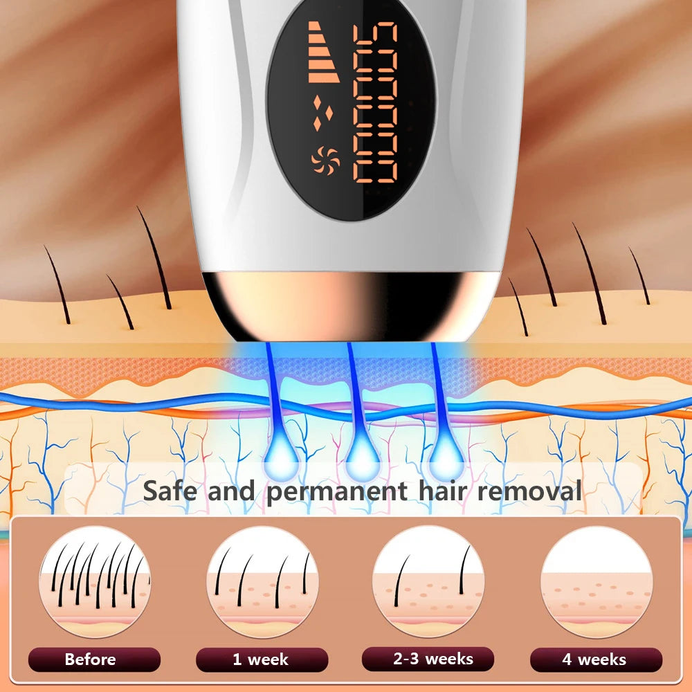 Portable hair removal device – Gradual reduction of hair regrowth